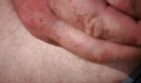 Chó gai sex nhat ban cái mặt